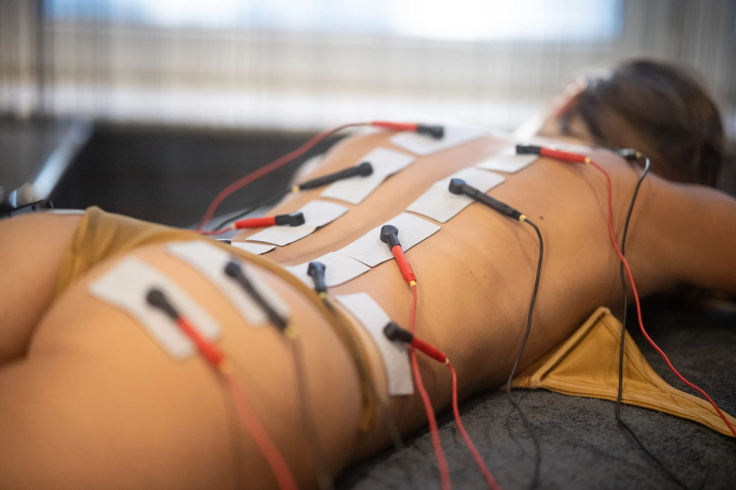 Das Bild zeigt den Rücken einer liegenden Frau, auf dem zahlreiche Elektrodenpads für eine elektromuskuläre Stimulation angebracht sind.