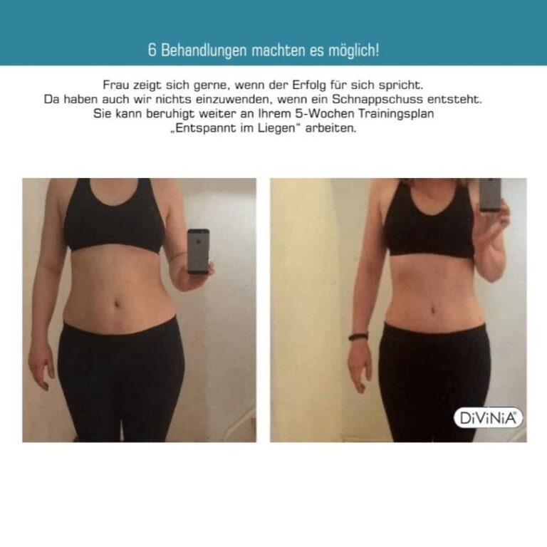 Das Bild zeigt eine Vergleichscollage mit Vorher-Nachher-Fotos nach 20 Divinia®-Behandlungen.